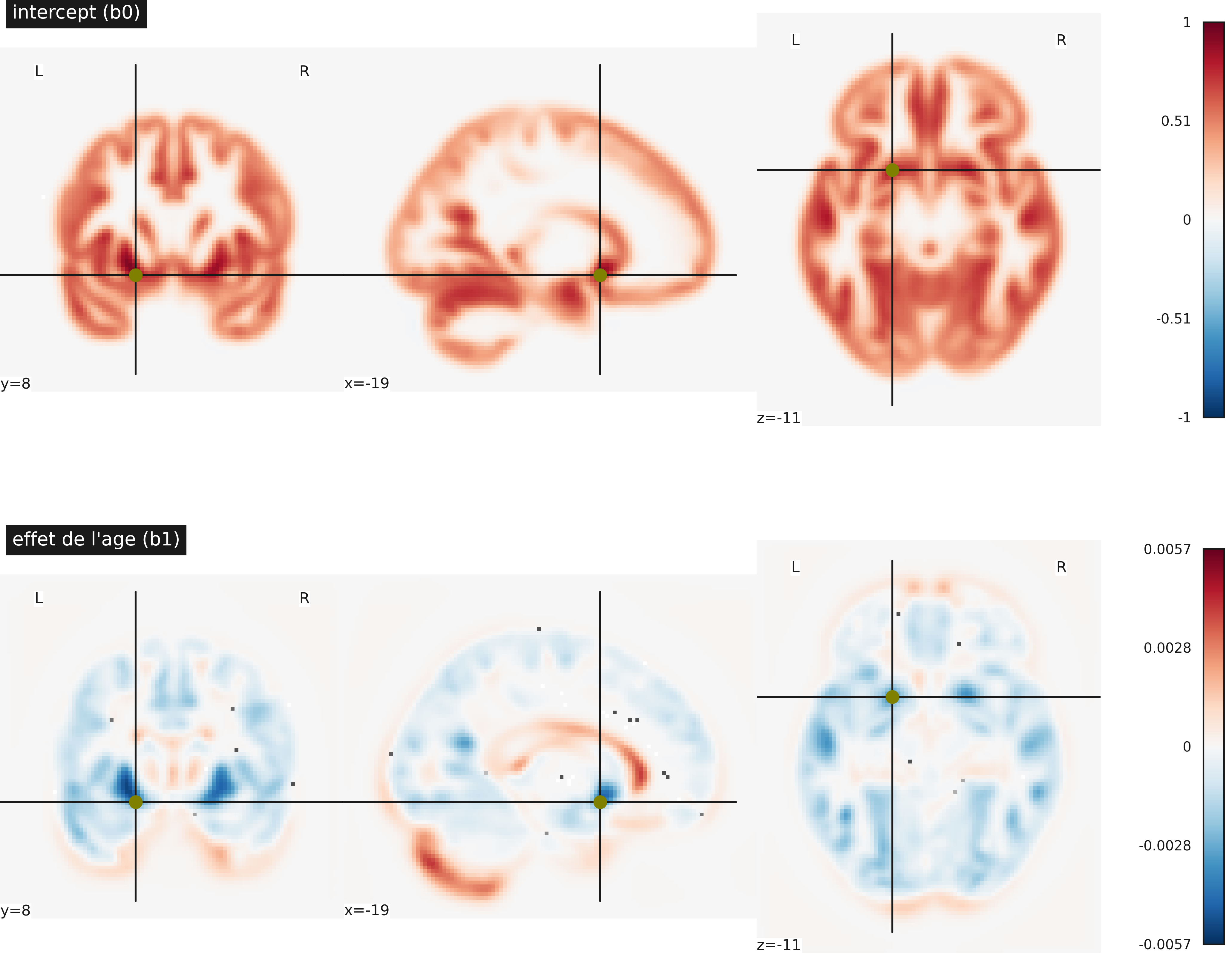 Cartes de paramètres statistiques dans une régression linéaire massivement univariée. Première ligne: intercept b0, deuxième ligne: effet linéaire de l’âge b1. Cette figure est adaptée d’un tutoriel de la librairie nilearn (cliquer sur + pour voir le code). Cette figure est distribuée sous licence CC-BY 4.0.