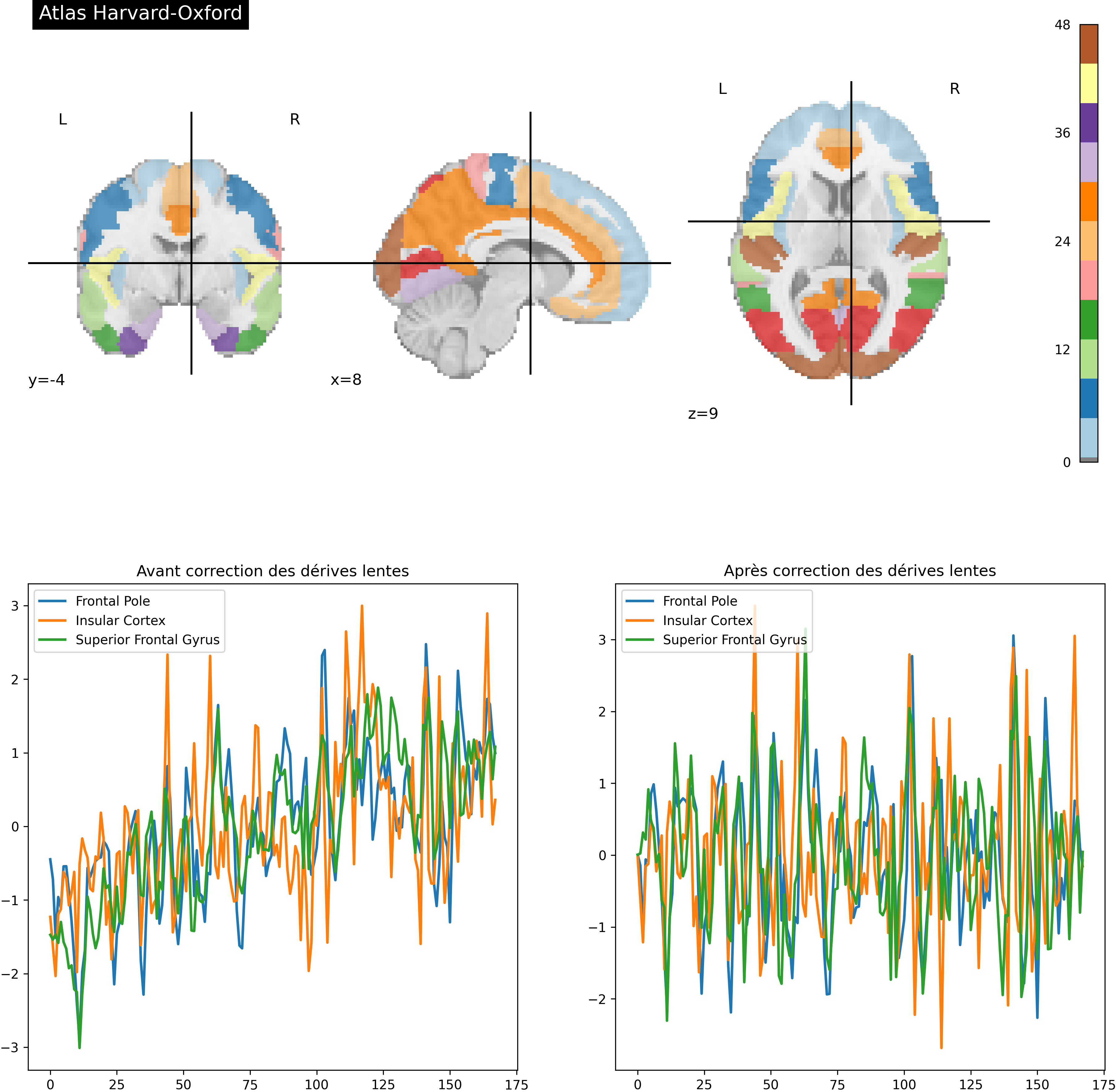 On extrait les séries temporelles associées à l’atlas Harvard-Oxford avant (à gauche) et après (à droite) régression des dérives lentes.
Cette figure est adaptée d’un tutoriel de la librairie nilearn à partir du jeu de données development_fmri (cliquer sur + pour voir le code). La figure est sous licence CC-BY.