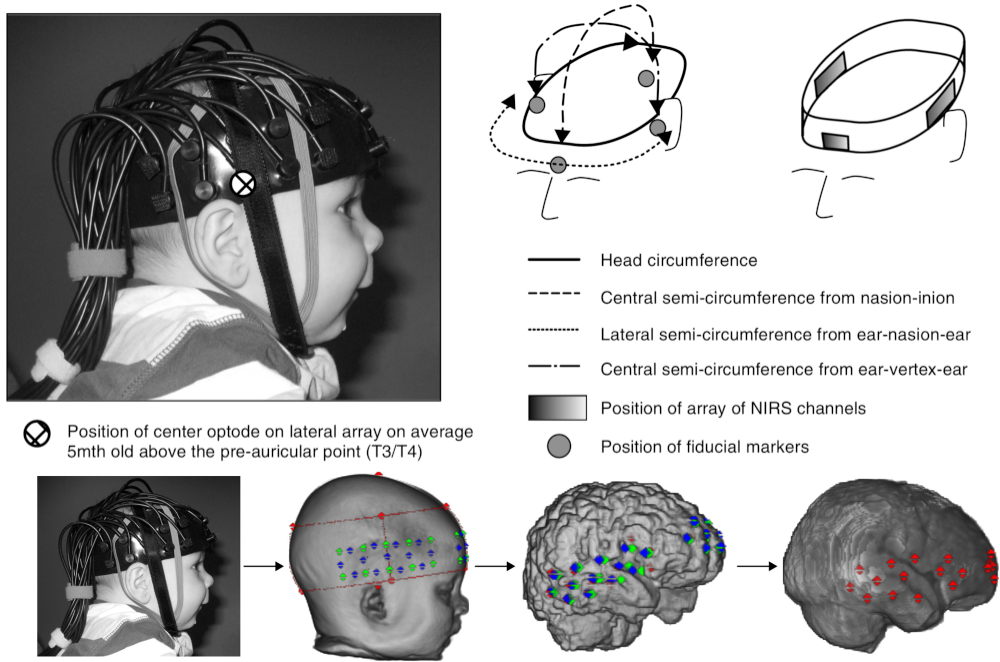 Points de repère sur la tête et alignement imagerie optique / IRM. Haut à gauche: installation d’un montage d’imagerie optique sur un jeune participant. Haut à droite: différents points de repères standards sont identifiés sur la tête du participant. Bas: ces mêmes points de repère sont manuellement identifiés sur une reconstruction 3D du visage en IRM. Ces points de repères sont utilisés pour recaler la position des émetteurs / récepteurs d’imagerie optique avec l’IRM structurelle du participant. Figure tirée de LLoyd-Fox et al. (2014) sous licence CC Attribution unported 3.0.