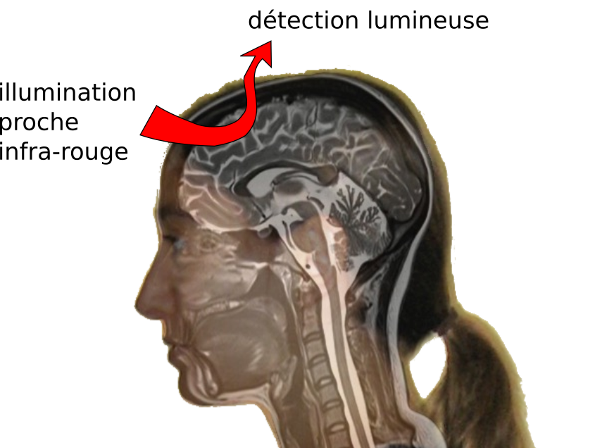 Illustration schématique du parcours de la lumière proche infrarouge au travers de la boîte crânienne et du cerveau. Image par Dr Julien Cohen-Adad et Dr Claudine Gauthier.