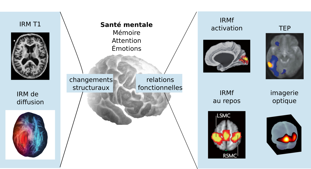 Illustration des techniques structurelles et fonctionnelles étudiées dans ce livre, ainsi que quelques applications possibles en neurosciences cognitives. Figure adaptée par P. Bellec à partir d’une variété de sources non libres de droit et inspirée du livre .