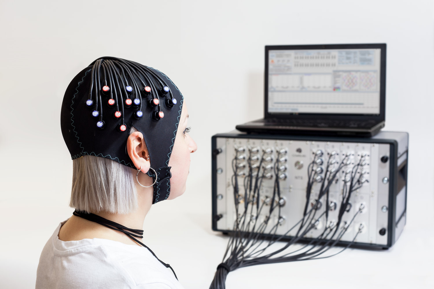 Système d’imagerie optique NTS gowerlabs. Image par Elisenicolegray tirée de wikimedia sous licence CC-BY-SA 4.0.