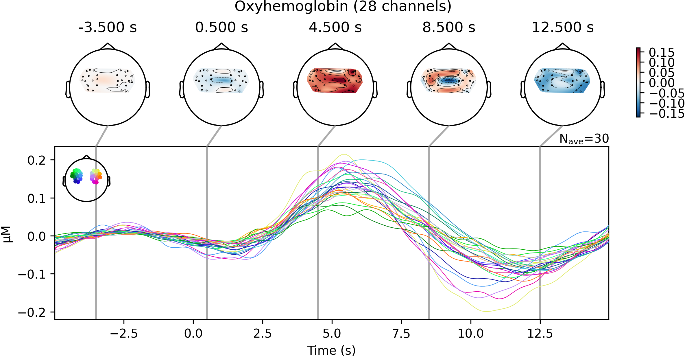 Potentiel évoqué par un mouvement du doigt à droite, pour l’ensemble des capteurs. La mosaïque de couleurs à gauche du graphe indique la localisation spatiale correspondant à chaque courbe. Pour différents points temps, une carte topographique d’activation indique le niveau d’activité évoquée pour chaque source spatiale, et pour chaque instant. Cette figure est générée par du code python adapté d’un tutoriel de la librairie MNE python (cliquer sur + pour voir le code), et est distribuée par P. Bellec sous licence CC-BY 4.0.