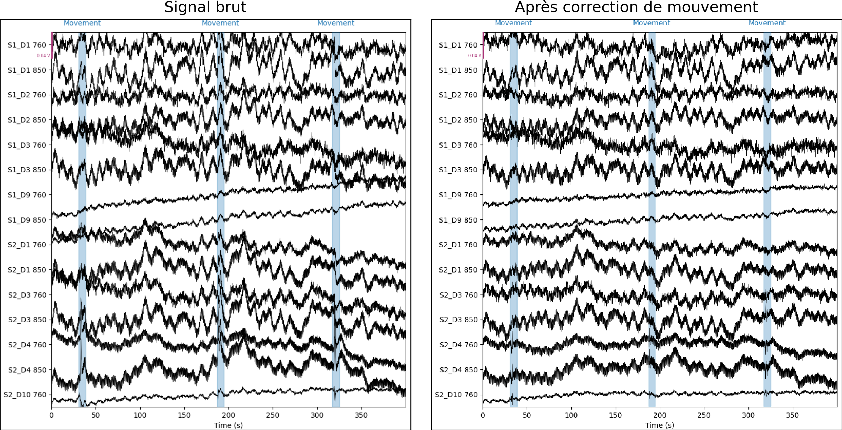 Corrections des artefacts de mouvement dans une acquisition d’imagerie optique. Figure générée par du code python adapté d’un tutoriel MNE python par P. Bellec sous licence CC-BY 4.0.