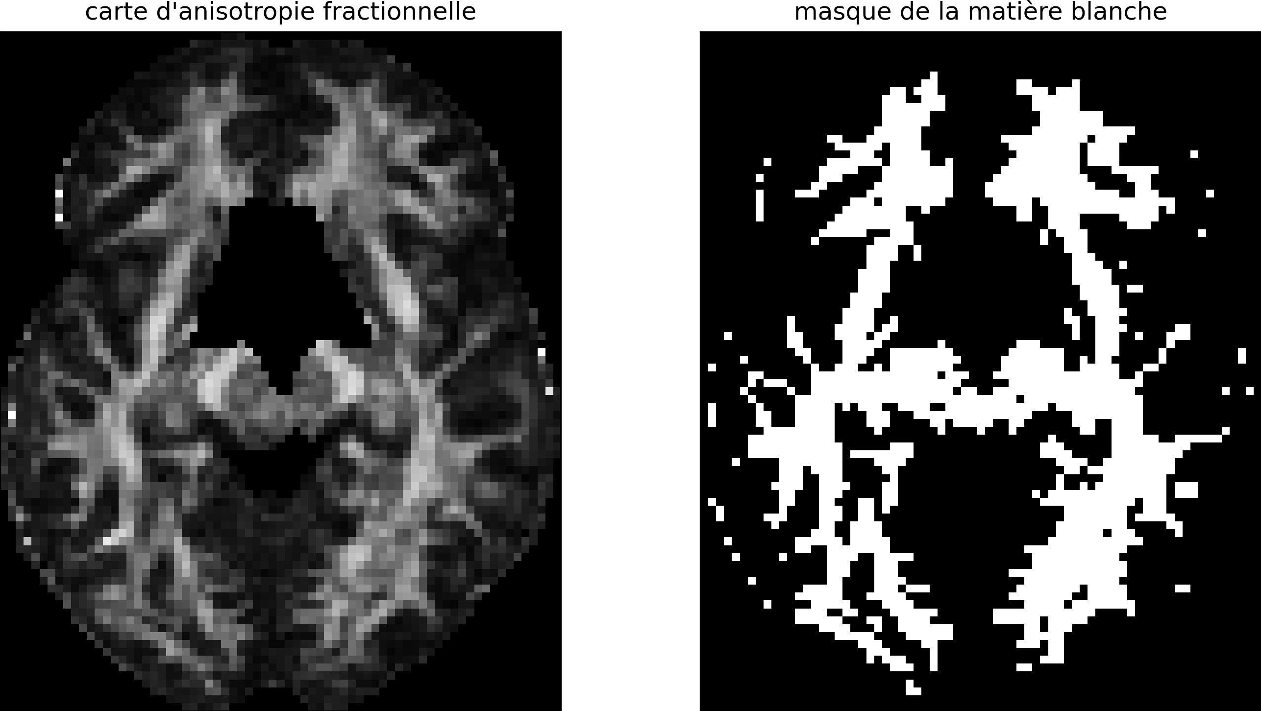 Carte d’anisotropite fractionnelle (gauche) et masque de la matière blanche obtenue par seuillage (droite). Figure générée par du code python adapté d’un tutoriel Dipy par P. Bellec sous licence CC-BY 4.0.