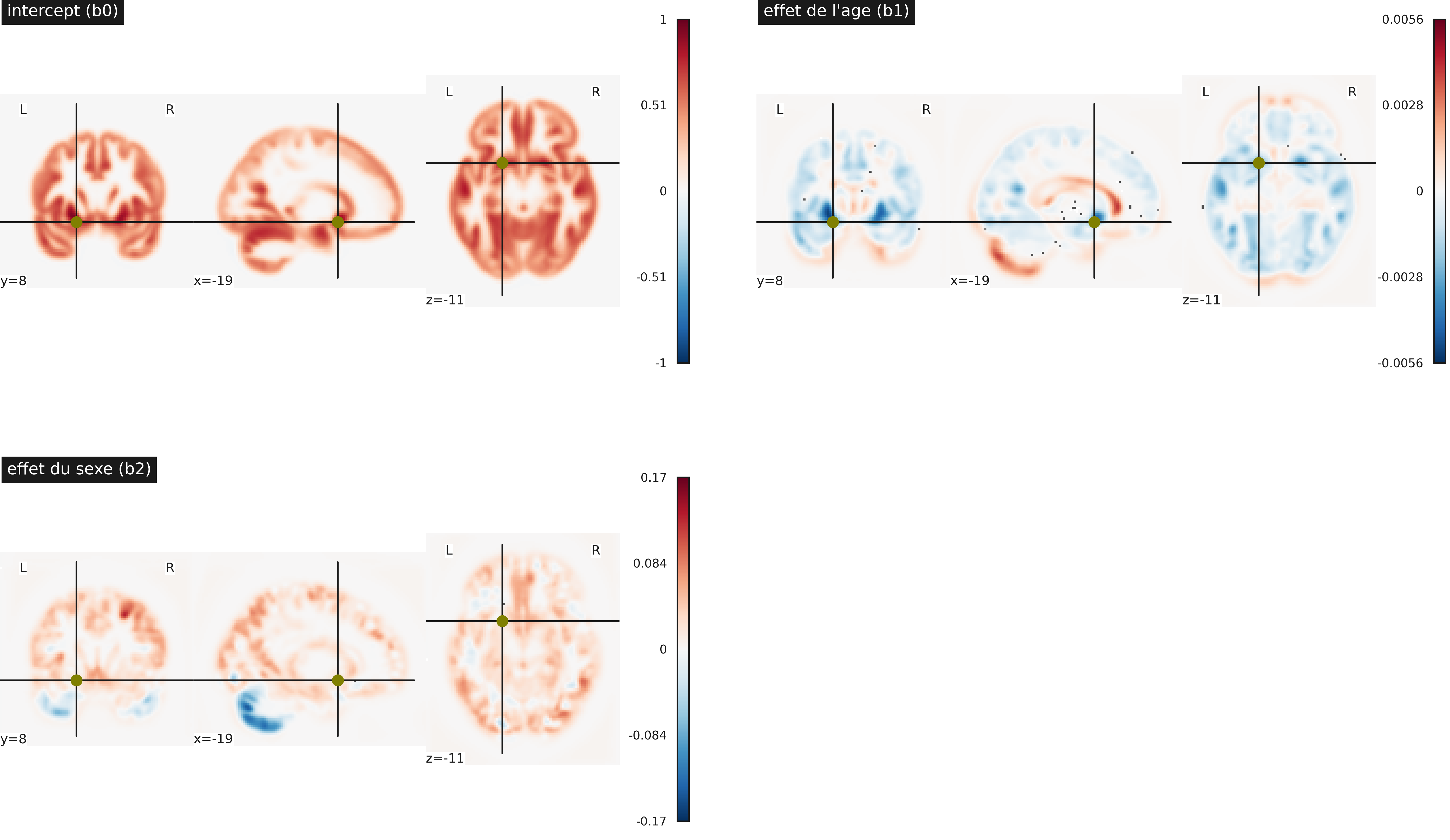 Cartes de paramètres statistiques dans une régression linéaire multiple massivement univariée. Haut gauche: intercept b0, haut droite: effet linéaire de l’âge b1, bas gauche: effet linéaire du sexe b2. Cette figure est adaptée d’un tutoriel de la librairie nilearn (cliquer sur + pour voir le code). Cette figure est distribuée sous licence CC-BY 4.0.